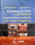 Reabilitacao Oral Com Protese Implantossuportada - Santos