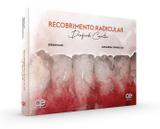 Recobrimento Radicular Desafiando Conceitos - Quintessence