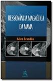 Ressonancia magnetica da mama - Revinter