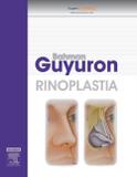 Rinoplastia