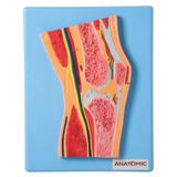Secção Mediana da Articulação do Joelho - Anatomic
