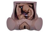 Simulador de Parto com 2 Fetos, Placenta e Cordão Umbilical - SDORF Scientific