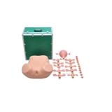 Simulador Ginecológico com Úteros Saudáveis e Patológicos - SDORF Scientific