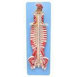 Tronco Cerebral Espinhal em Tamanho Natural em Prancha - Sdorf