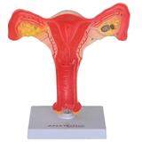 Útero com Trompas em Tamanho Natural - Anatomic
