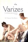 VARIZES CONHECER PARA PREVENIR - 4ª ED - Folium
