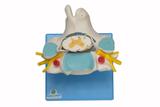 Vértebra Cervical c/Cordão Espinhal Modelo Anatomia - Sdorf