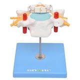 Vértebra Cervical c/Cordão Espinhal Modelo Anatomia - Sdorf