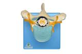 Vértebra Torácica com Cordão Espinhal SD-5014 - SDORF Scientific