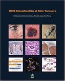 Who Classification Of Skin Tumours - World health organization