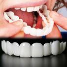 2 pares de dentes ajustáveis com aparência natural para homens e mulheres