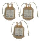 3 Bolsas Satélite transferência de Hemocomponentes 300 mL