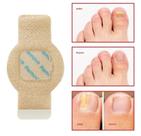 32 tarjas antifungicas para eliminar fungos e mau odor das unhas. 32 tarjas antifungicas para eliminar fungos e mau odor das unhas.