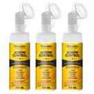 3x Mousse Micelar Espuma de Limpeza Facial Acnow Control Acido Hialuronico 150ml