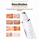 Aparelho de Peeling Ultrassônico Profissional Espátula Facial Skin Scrubber Limpeza de Pele Top Aparelho de Peeling Ultrassônico Profissional Espátula Facial Skin Scrubber Limpeza de Pele Top