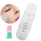 Aparelho Limpeza Facial Peeling Ultrassônico Portátil Skincare