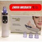 Aparelho Multifuncional Extrator de Cravo Limpa os Poros Aspirador a Vácuo Limpeza Facial Peling Remove Oleosidade Aparelho Multifuncional Extrator de Cravo Limpa os Poros Aspirador a Vácuo Limpeza Facial Peling Remove Oleosidade