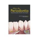 Atlas de periodontia - QUINTESSENCE NACIONAL -