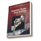 Aumento osseo na area estetica - SANTOS Aumento osseo na area estetica - SANTOS