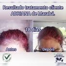 Calvície e queda de cabelo