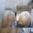 Calvície e queda de cabelo