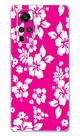 Capa Adesivo Skin182 Verso Para Vivo X50 Pro (2020)