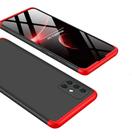 Capa Capinha 360 Samsung Galaxy A51 Tela 6.5 Anti Impacto