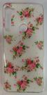 Capa Capinha Compatível Com motolora Moto One Fusion Plus Xt2067-2 Colorido Diversas Cores Bonito