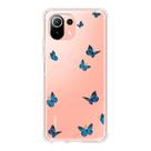 Capa Capinha De Celular Compatível com Xiaomi MI 11 Lite Mi Personalizada