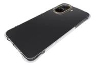Capa Película ou Kit para Xiaomi Redmi A5 Capa Película ou Kit para Xiaomi Redmi A5