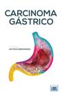 Carcinoma Gástrico