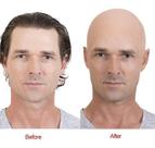 Careca Falsa De Látex Fantasia Personagens
