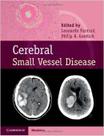 Cerebral small vessel disease