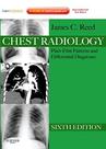 Chest Radiology - Plain Film Patterns And Differential Diagnoses - ELSEVIER (IMPORTADOS) Chest Radiology - Plain Film Patterns And Differential Diagnoses - ELSEVIER (IMPORTADOS)