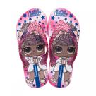 Chinelo infantil lol surprise shine i - rosa/rosa metálico
