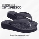Chinelo Ortopédico para Esporão E Fascite Plantar Original Chinelo Ortopédico para Esporão E Fascite Plantar Original