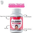 Colágeno Hidrolisado 100 Cápsulas 500mg