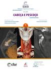 Coleção CBR Volume 1 Cabeça E Pescoço - EDITORA DOS EDITORES EIRELI - ADMINISTRATIVO Coleção CBR Volume 1 Cabeça E Pescoço - EDITORA DOS EDITORES EIRELI - ADMINISTRATIVO
