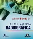 Controle do Caos