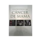 Controvérsias em Cancêr de Mama - GOY EDITORA