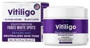 Creme Aura Vitaminas Vitiligo Repigmentante 119ml