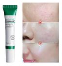 Creme De Ácido Salicílico Para Redução De Poros 20ml