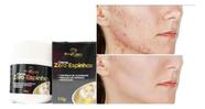 Creme Para Acnes 50g