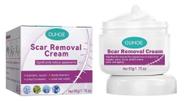 Creme Para Cicatrizes Pretas Remover Feridas Antigas