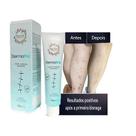Creme Para Marcas Cicatrizes Na Pele 20g DermaTriz Zt.