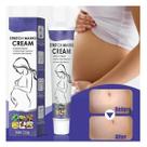 Creme Reparador de Estrias de Gestação & Pós Parto Stretch Marks