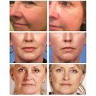 Creme Retinol Firmador e Levantador Rugas