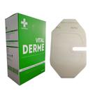 Curativo Transparente De Poliuretano Com FENESTRA - 6 x 7 cm - 20 unidades - VITAL DERME Curativo Transparente De Poliuretano Com FENESTRA - 6 x 7 cm - 20 unidades - VITAL DERME