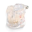 Dentes dentários modelo Yosoo Health Gear Dentário para Implante Dentário Dentes dentários modelo Yosoo Health Gear Dentário para Implante Dentário