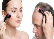 Dermaroller 540 pontos de microagulhamento Skin Roller Facial, rosto, barba, clavície modelo 1mm